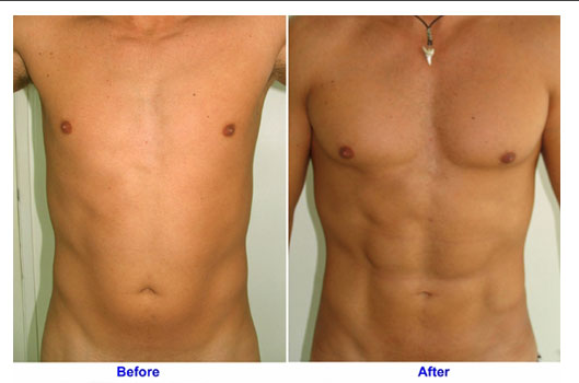 Men and Plastic Surgery: Most Popular Procedures, Celebrities, and More ...