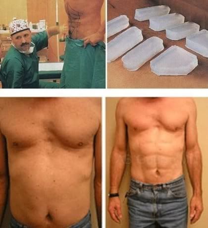 ab-implants-men.jpg